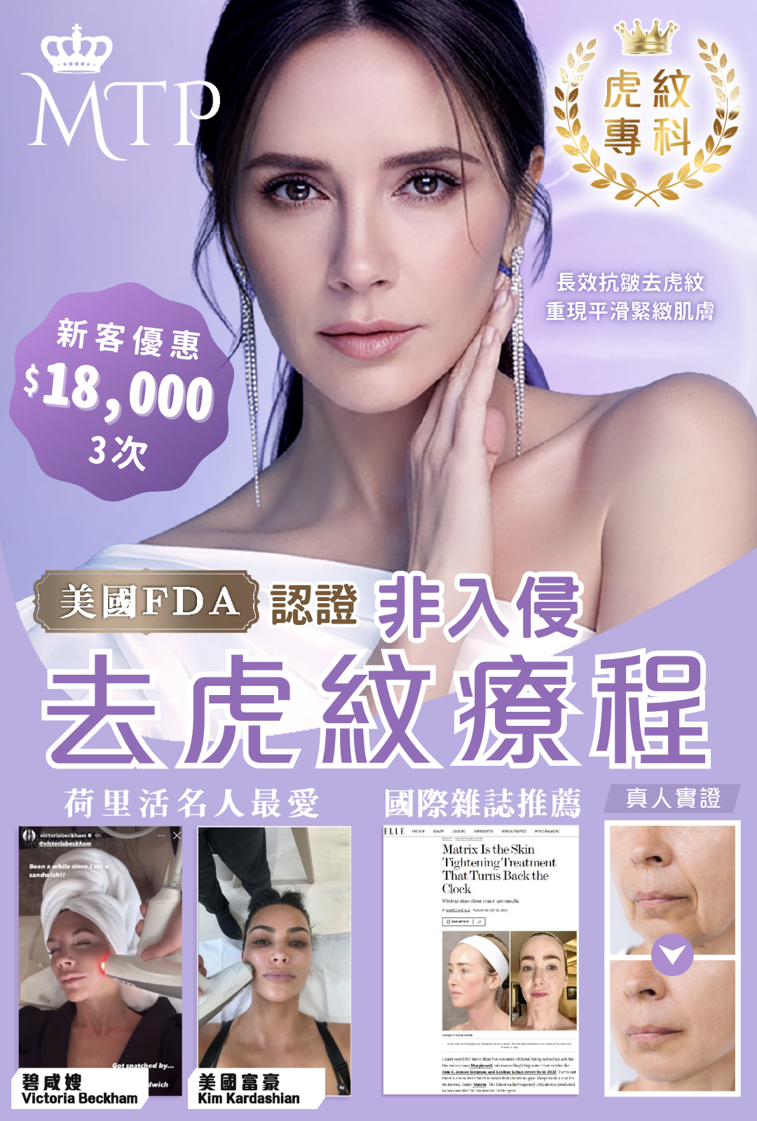 MTP虎紋療程