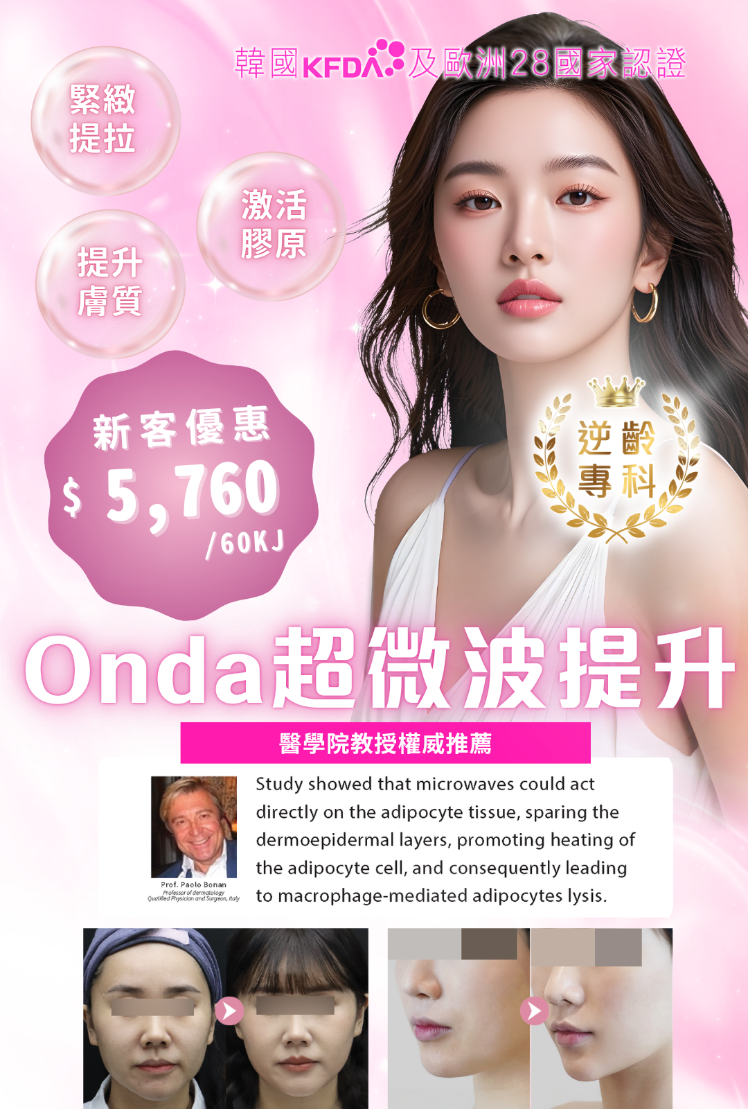 Onda Lifting 超微波提升