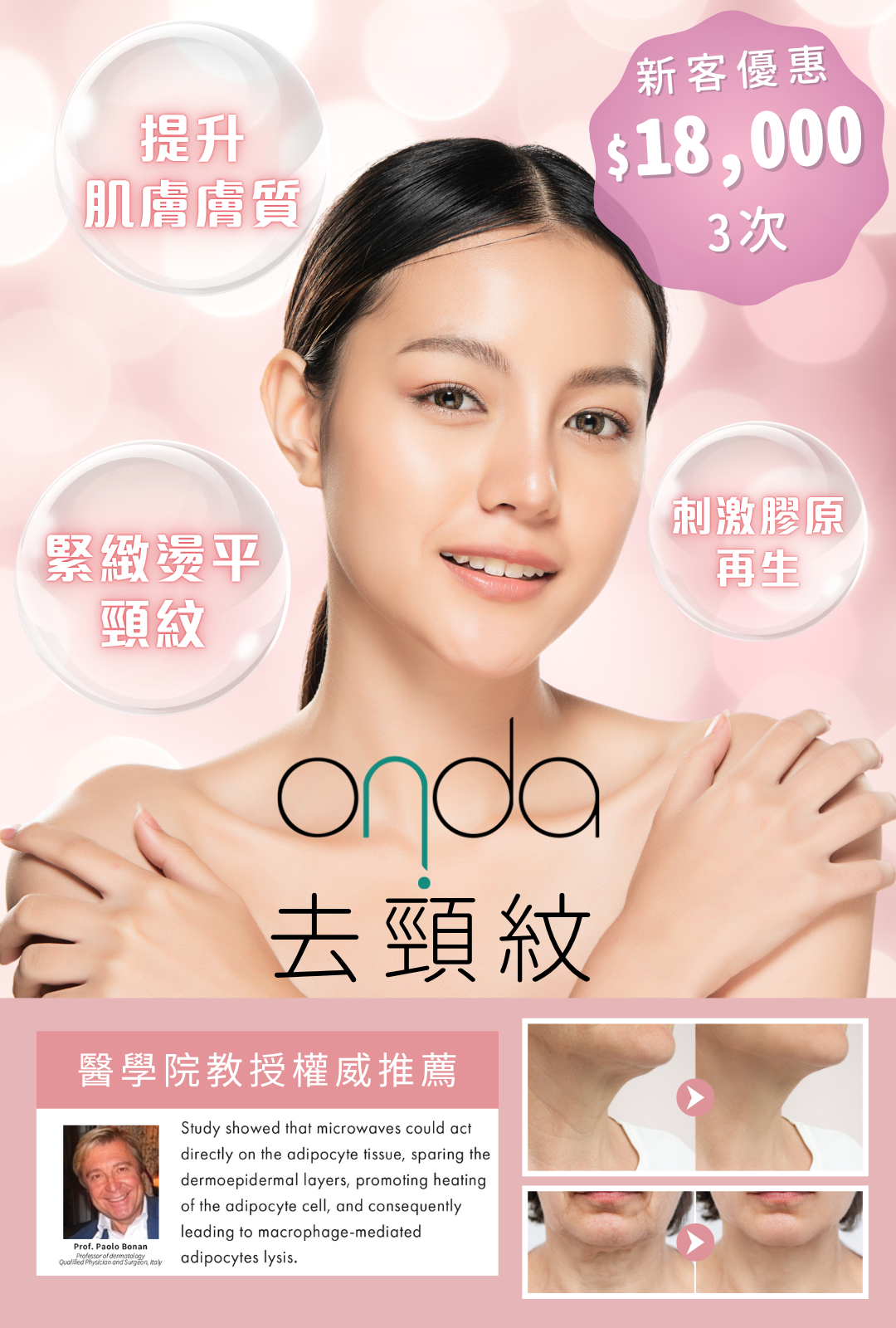 Onda 去頸紋
