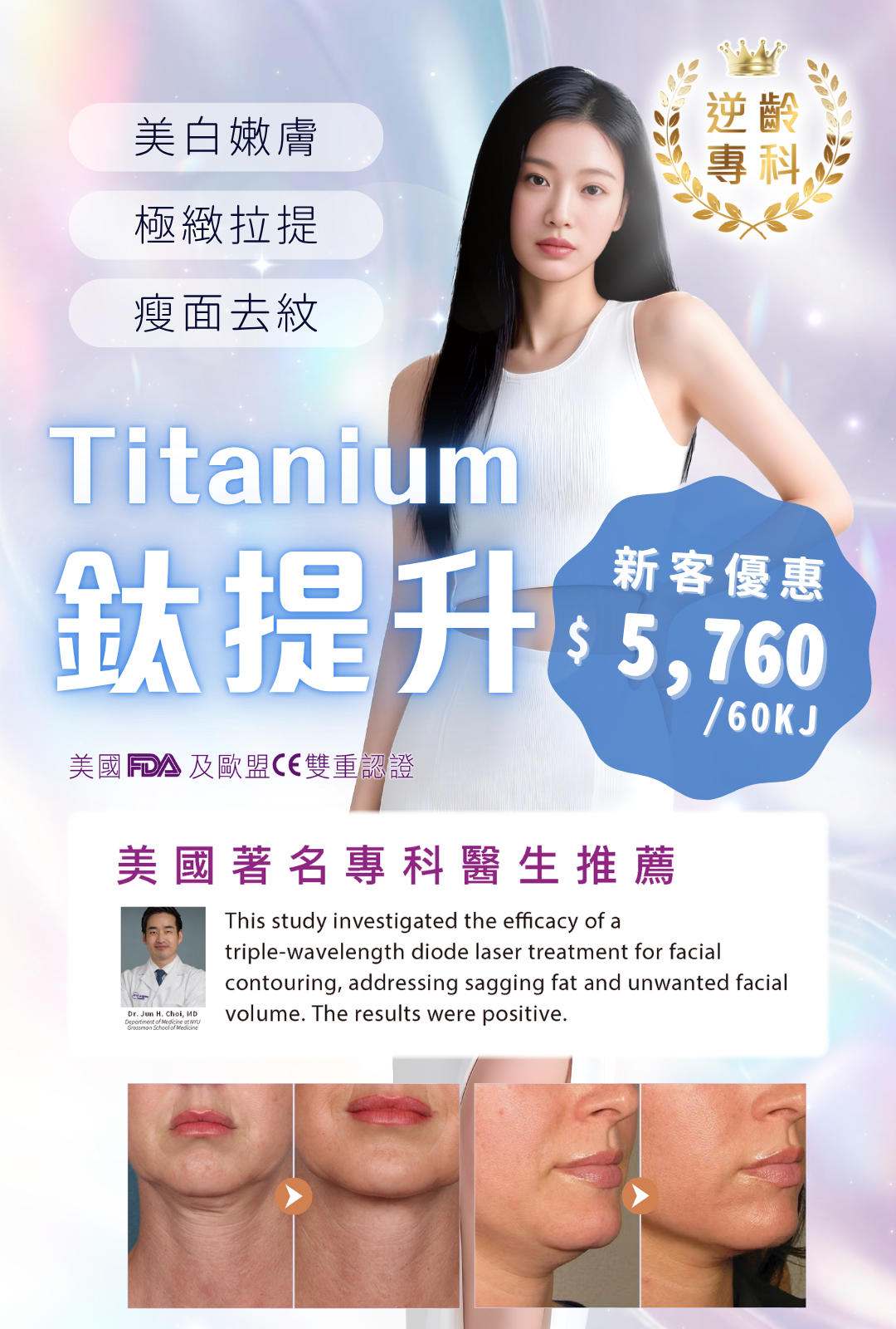 Soprano Titanium 鈦提升