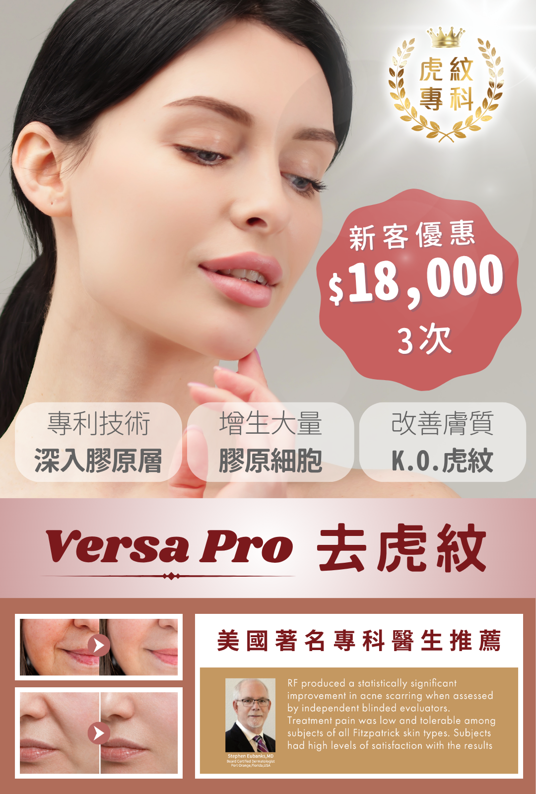 Versa Pro 去虎紋